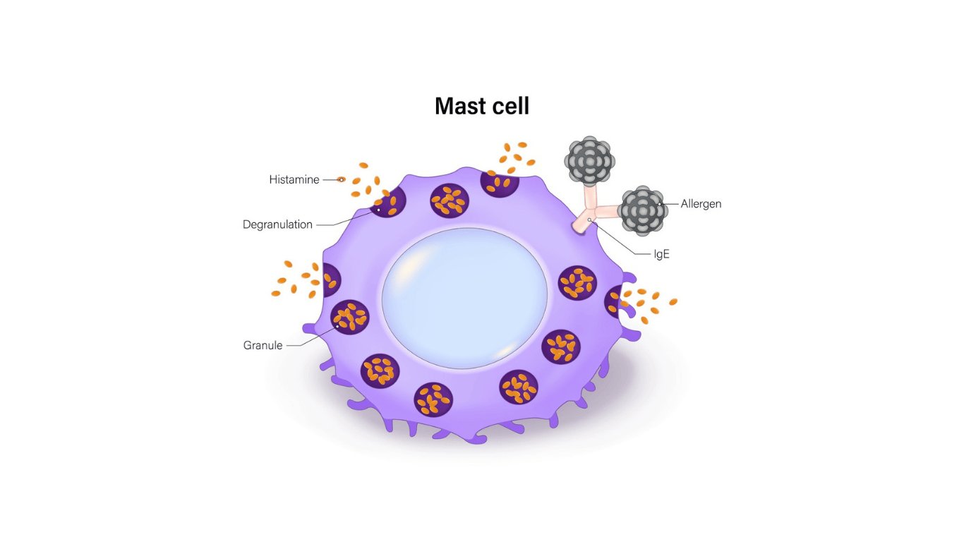 Non-Allergic Cell-Mediated Rhinitis