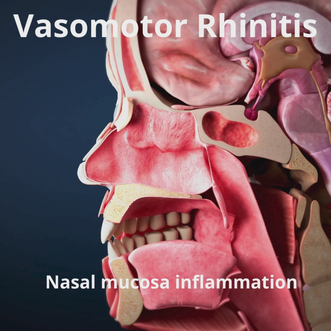 Load video: Celmast Nasal Spray - Adult